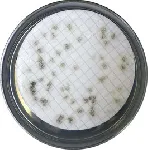 R2A Agar