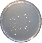 Plate Count Skim Milk Agar