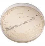 Reinforced Clostridial Agar