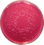 Rose Bengal Chloramphenicol Agar
