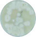 Sabouraud Dextrose Agar