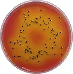 Salmonella Shigella Agar (SS Agar)