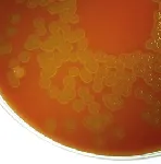 Blood Agar Base