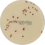 Slanetz Bartley Agar