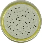 Tryptone Sulfite Neomycin Agar (TSN Agar)