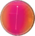 Urea Agar Base
