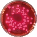 Violet Red Bile Lactose Agar (VRBL Agar)