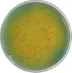 WL Nutrient Agar