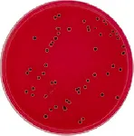 Xylose Lysine Deoxycholate Agar (XLD Agar) (Eur. Pharm.)