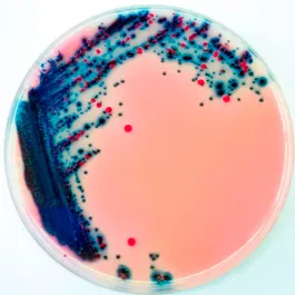 CHROMOGENIC MEDIA CHROMagar™