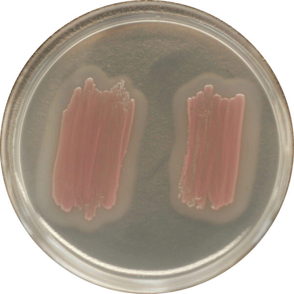 CHROMagar™ Identification Listeria