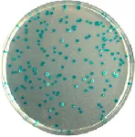 CHROMagar™ E. coli