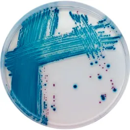 CHROMOGENIC MEDIA CHROMagar™