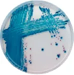 CHROMagar™ STEC