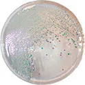 CHROMOGENIC MEDIA CHROMagar™