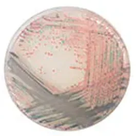 CHROMOGENIC MEDIA CHROMagar™