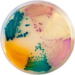 CHROMOGENIC MEDIA CHROMagar™