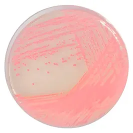 CHROMOGENIC MEDIA CHROMagar™