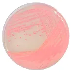 CHROMagar™ MRSA
