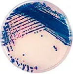 CHROMagar™ Strep B