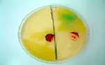 Oxidase Test