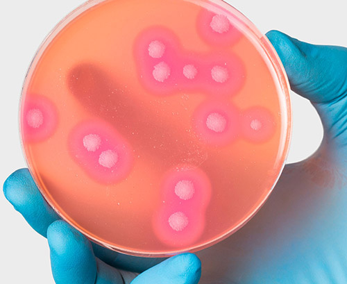 Crecimiento de colonias bacterianas en una placa de Petri sujetada por una mano con guante azul