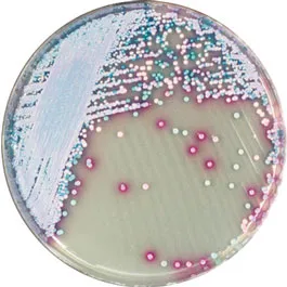 CHROMOGENIC MEDIA CHROMagar™