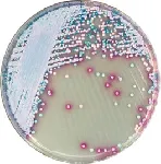 CHROMagar™ Malassezia