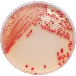 CHROMOGENIC MEDIA CHROMagar™