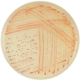 CHROMOGENIC MEDIA CHROMagar™