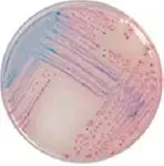 CHROMagar™ Salmonella