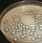 Tributyrin Agar