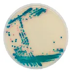 CHROMagar™ ESBL