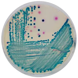 CHROMOGENIC MEDIA CHROMagar™