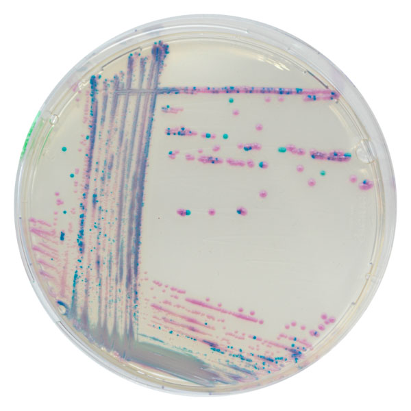 CHROMagar™ Streptococcus