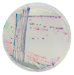 CHROMagar™ Streptococcus