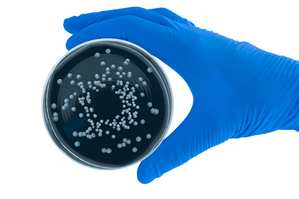 Control de Legionella: aspectos a considerar para la detección según la ISO 11731:2017