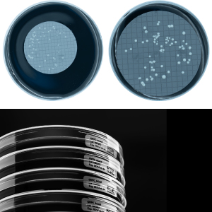 Medios de cultivo para el control de legionella