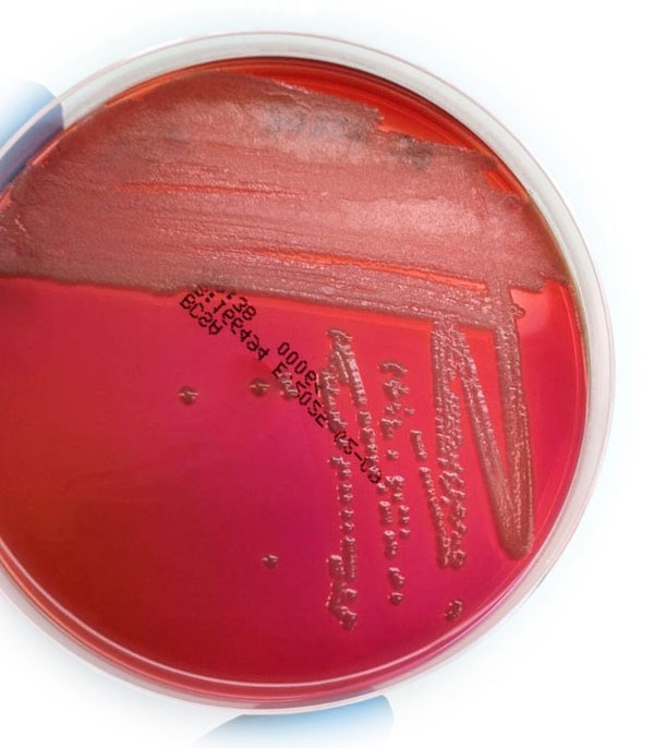 TALLER Scharlau en LABFORUM: Control de Burkholderia cepacia USP-NF 60